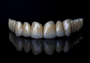 ceramic teeth dental treatment